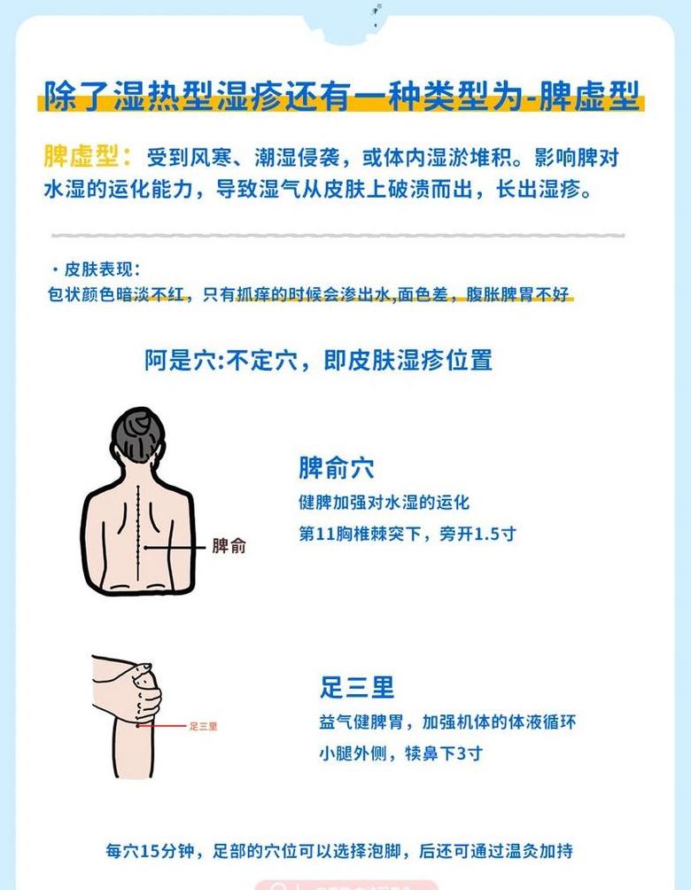 湿疹自愈可能性解析