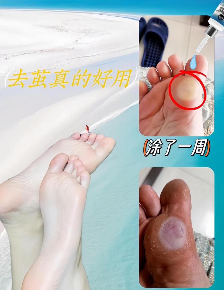 泡脚按摩脚底疼痛原因及应对方法