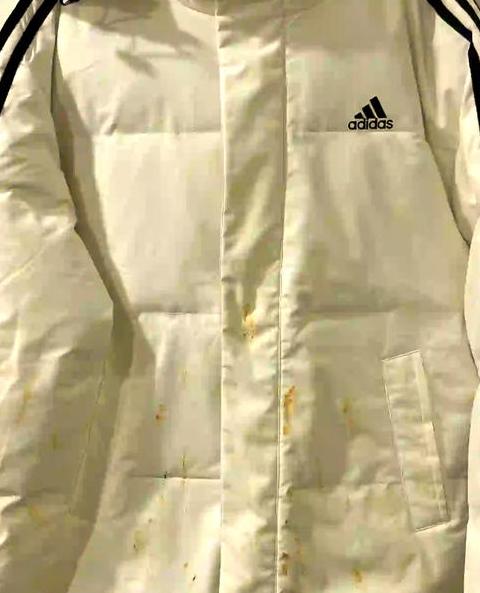 白色羽绒服油渍清洁小技巧