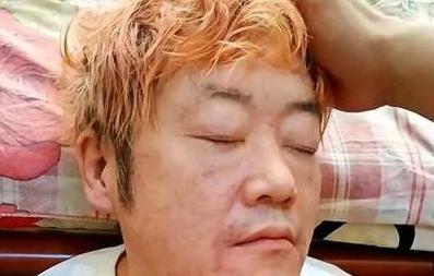 喝酒后晕倒