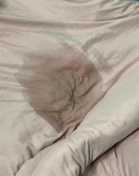猫咪绝育后不排便，3天内正常？
