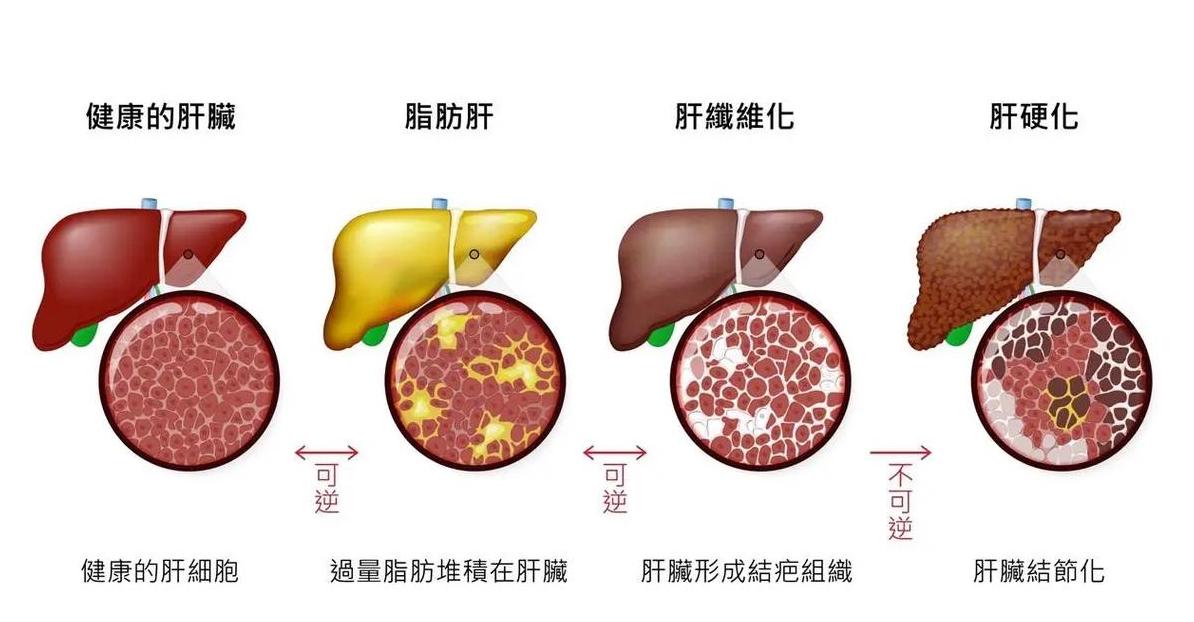 氢化植物油与普通植物油：5大关键区别揭秘